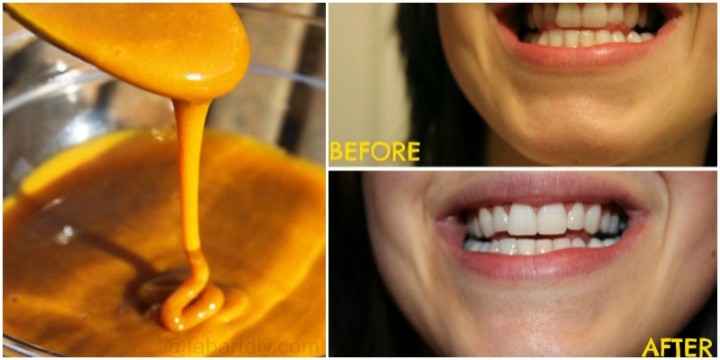how-to-whiten-your-teeth-with-turmeric-naturally-fabartdiy-video-e1453105141494