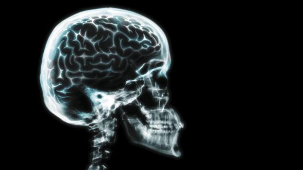 big human brain