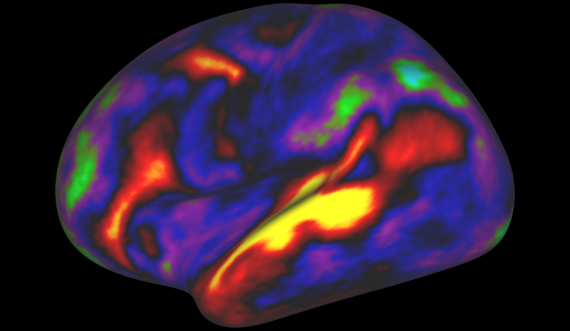 Matthew F. Glasser, David C. Van Essen The pattern of brain activation (red, yellow) and deactivation (blue, green) in the left hemisphere when listening to stories while in the MRI scanner.