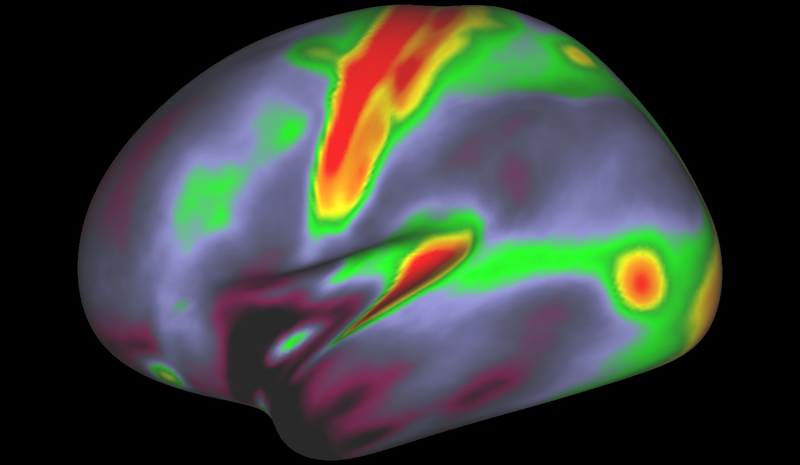 Matthew F. Glasser, David C. Van Essen A map of myelin content (fatty insulation surrounding the brain’s nerves) in the left hemisphere of the cerebral cortex.