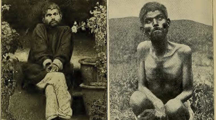 wolf-boy