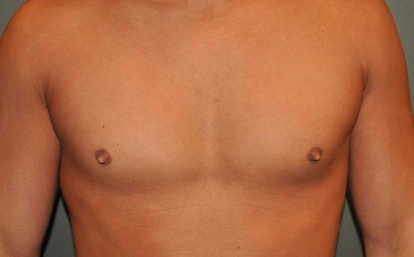 Male Nipples