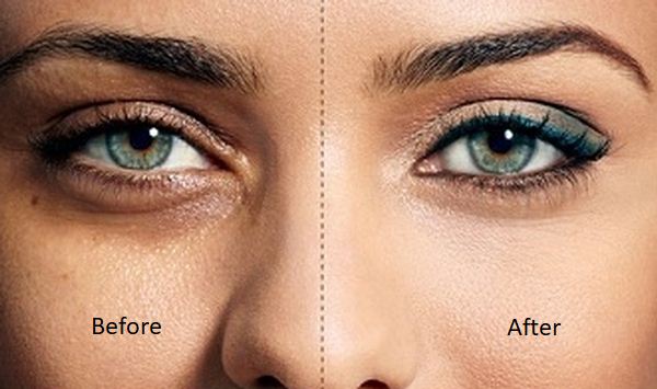 Dark Circles